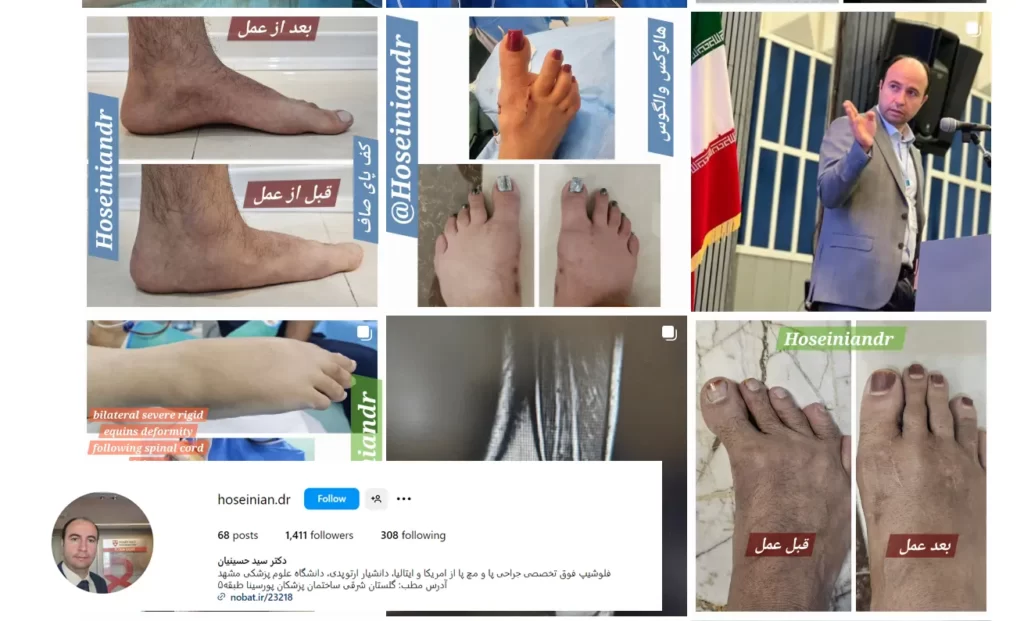 قبل و بعد عمل های دکتر حسینیان متخصص ارتوپدی در مشهد